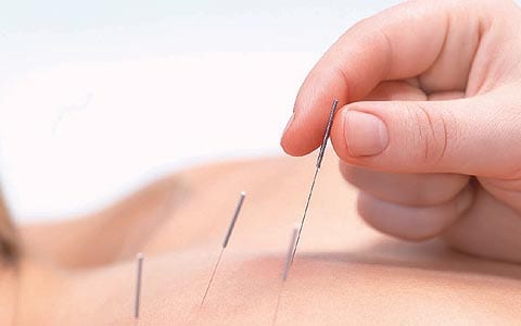 Alternate treatment for Spinal surgery