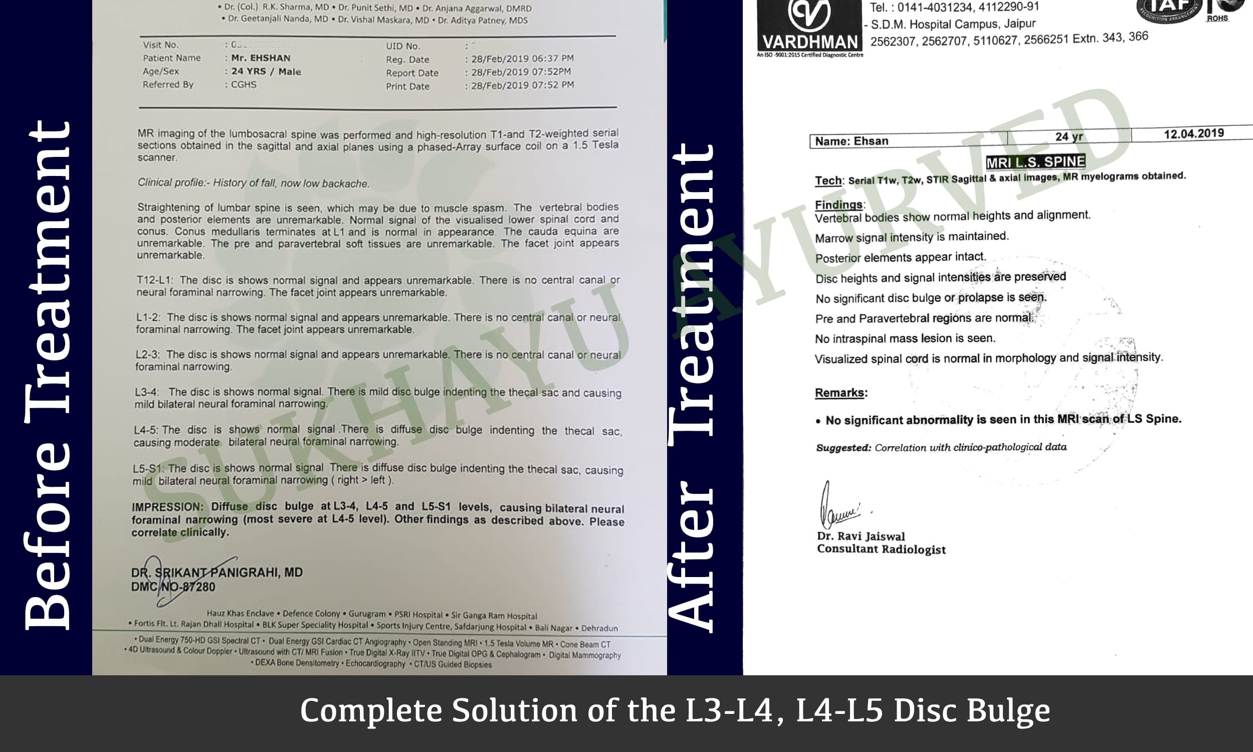 Can herniated disc return to normal?