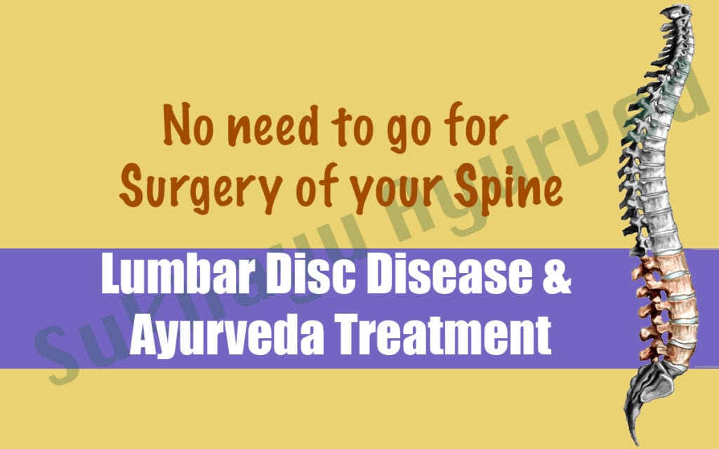 Ayurveda treatment for lumbar disc disease