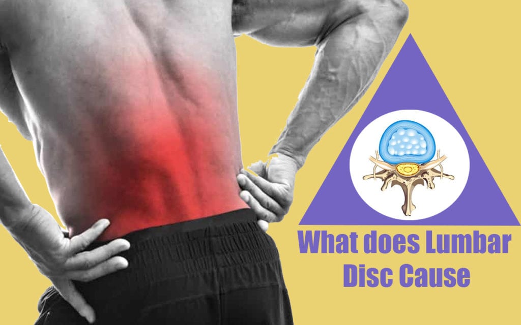 Symptoms of lumbar disc disease