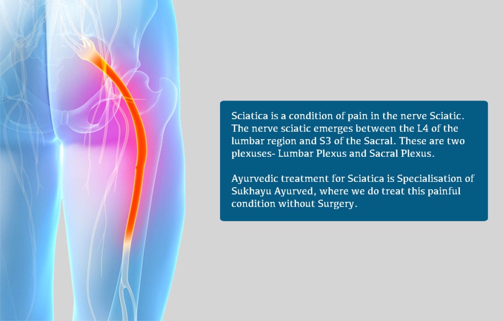 Ayurvedic Treatment for Sciatica