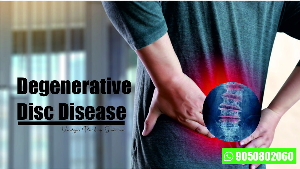 Degenerative Disc Disease
