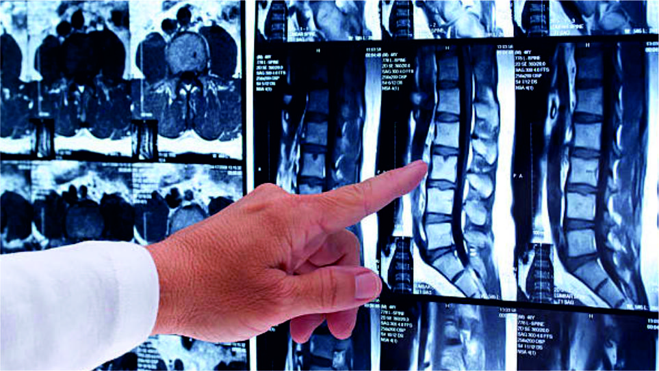 What does MRI tell