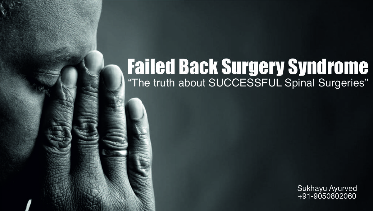 failed back surgery syndrome