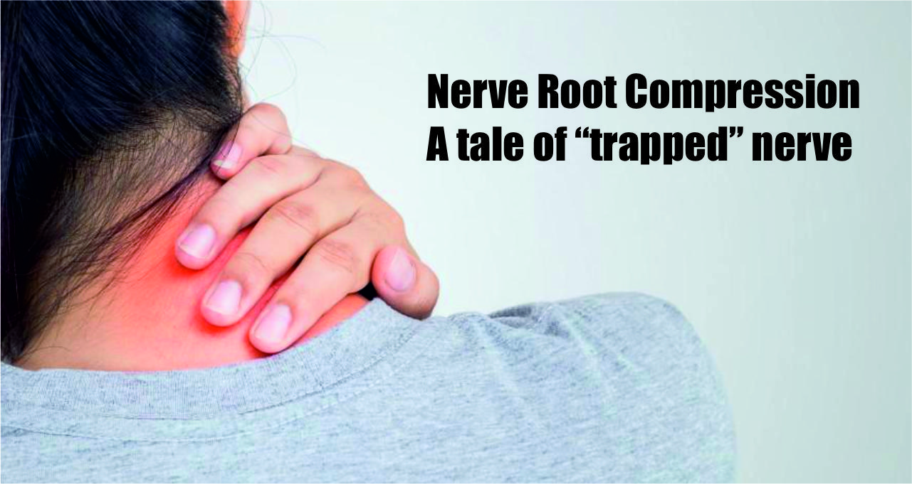 nerve root compression